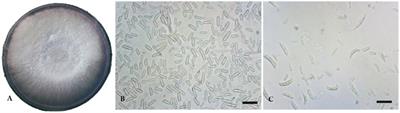 Levering proteomic analysis of Pseudomonas fluorescens mediated resistance responses in tomato during pathogenicity of Fusarium oxysporum f. sp. oxysporum